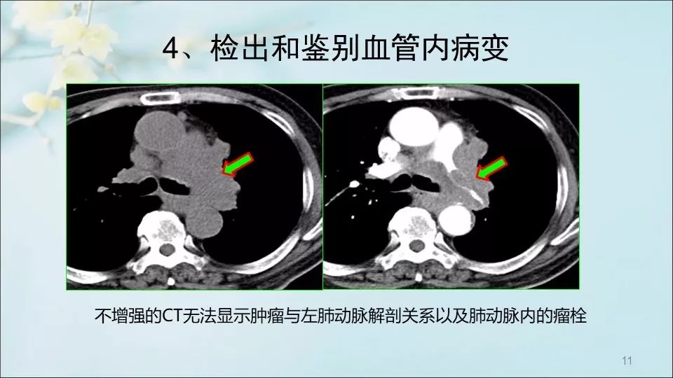 最新版的CT技术，革新与应用